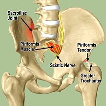What does sacroiliac joint pain feel like?